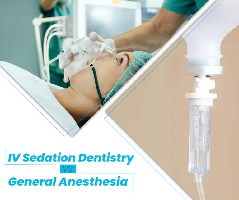 IV Sedation Dentistry vs. General Anesthesia IV Sedation Dentistry vs. General Anesthesia